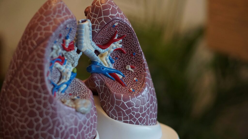 Preventive Health - Lung Cancer